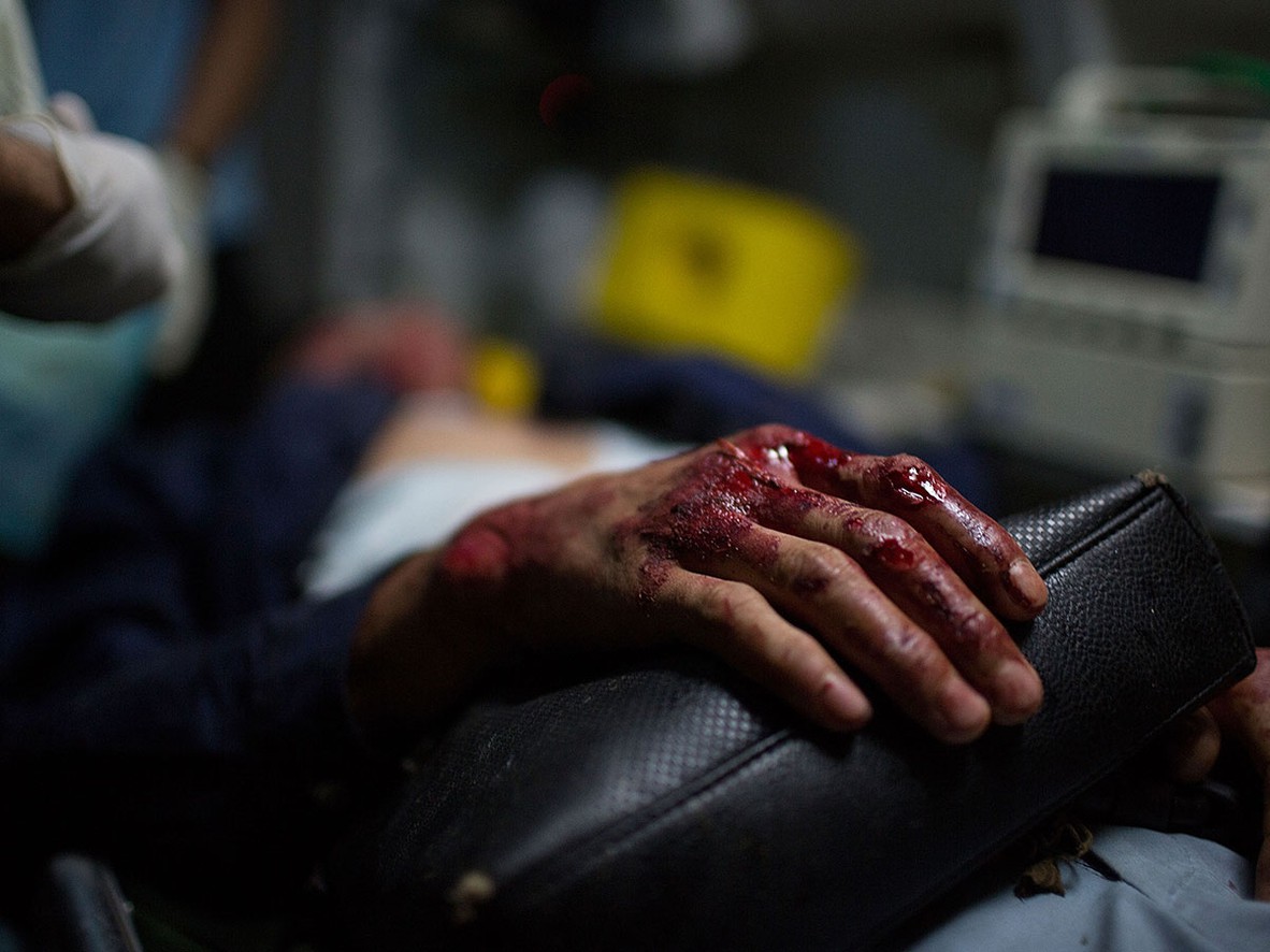 Five Horrifying Reasons Not to Ride a Motorcycle